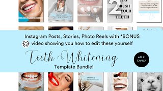 Dental Instagram Social Media Templates Made For You by Dentalelle with Andrea 82 views 2 months ago 5 minutes, 22 seconds