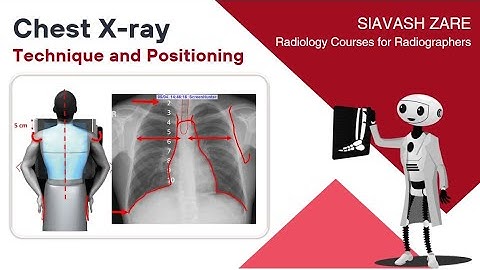 Chest X-ray (PA) Technique and Positioning