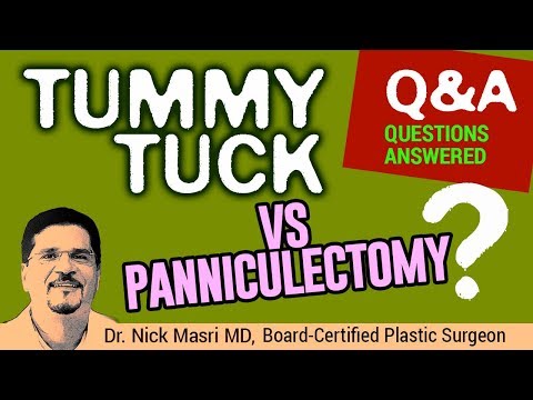 Video: Panniculectomy Vs. Tummy Tuck: Apa Yang Harus Diharapkan, Pemulihan, Kos