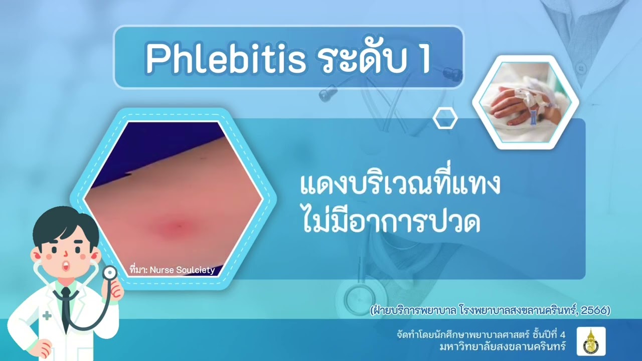 ภาวะหลอดเลือดดำอักเสบ (Phlebitis) หอผู้ป่วยพิเศษเฉลิมพระบารมี 9 โรงพยาบาลสงขลานครินทร์