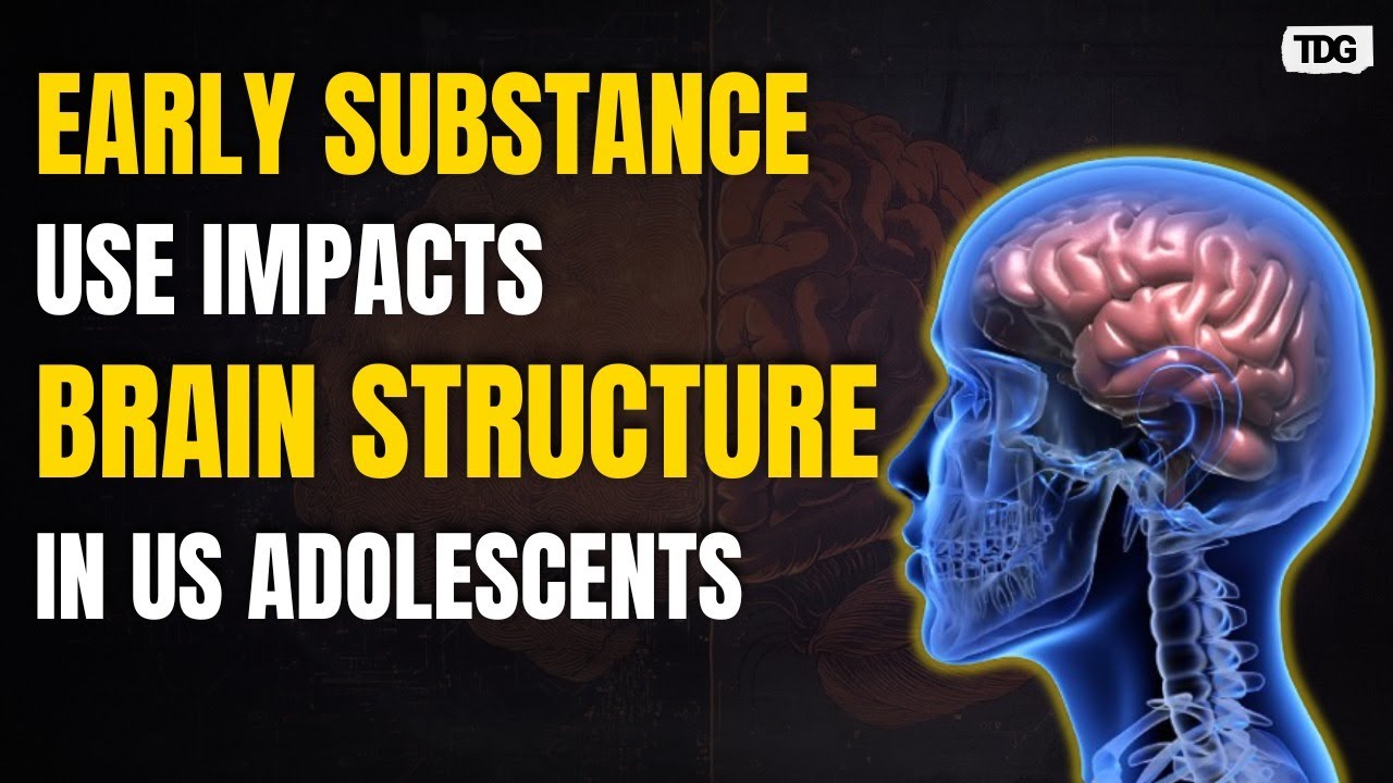 US Teens Brain Structure Study Links Early Substance Use Risk - YouTube