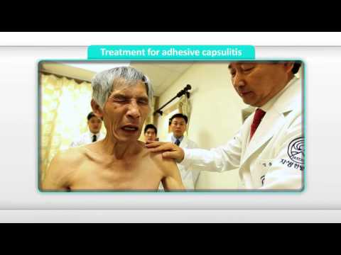 [Treatment] Treatment for Adhesive Capsulitis of shoulder