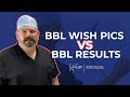 BBL Wish Pics vs BBL Results