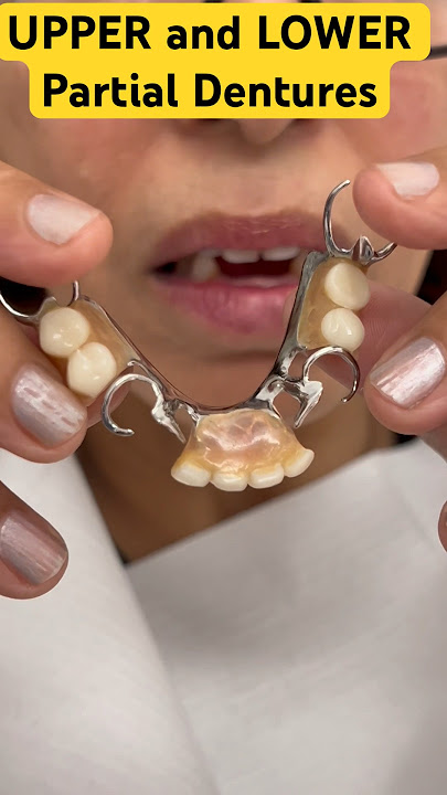 UPPER and LOWER Partial Dentures #youtubeshorts #shorts#viral