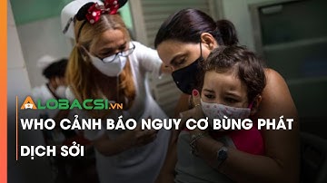 WHO cảnh báo nguy cơ bùng phát dịch sởi