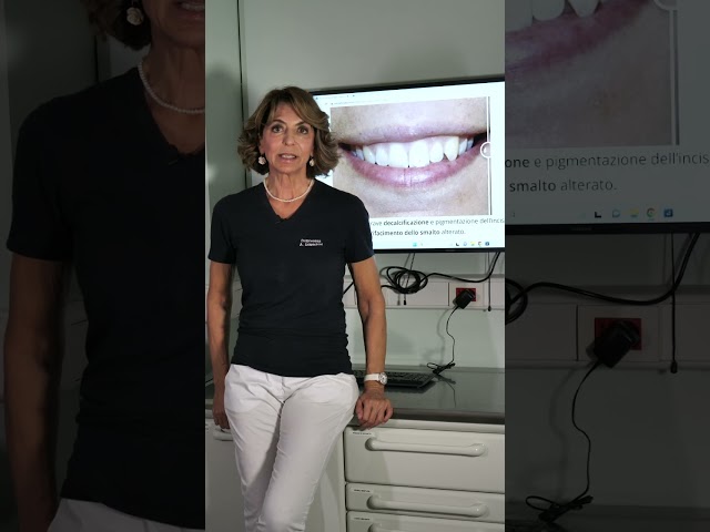 Denti con smalto alterato e scuro: come renderli più luminosi?