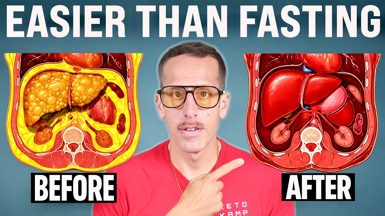 I Reversed My Fatty Liver Fast – Try These 3 Things Tod… — Transcript