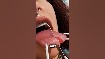Why do doctors split patients’ tongues?😱👅