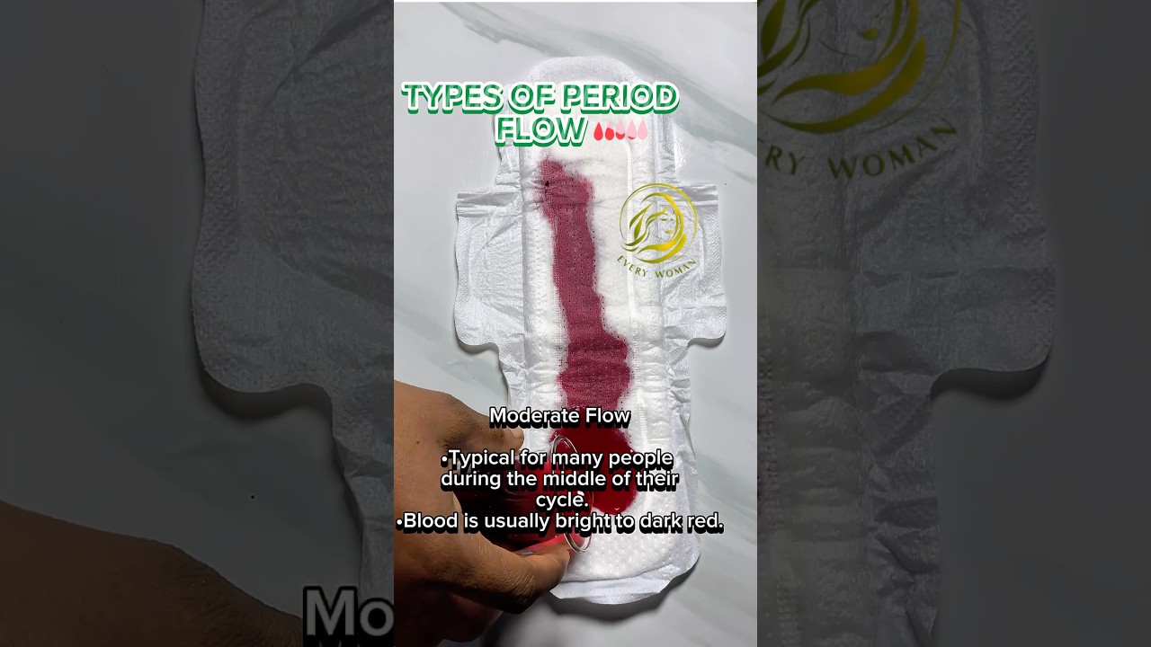 TYPES OF PERIOD FLOW. 