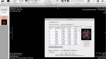 DTIMap (Osirix Plugin) Demo