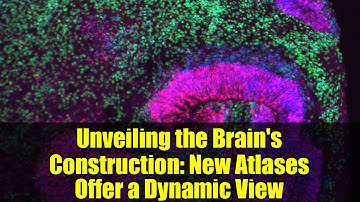 Unveiling the Brain