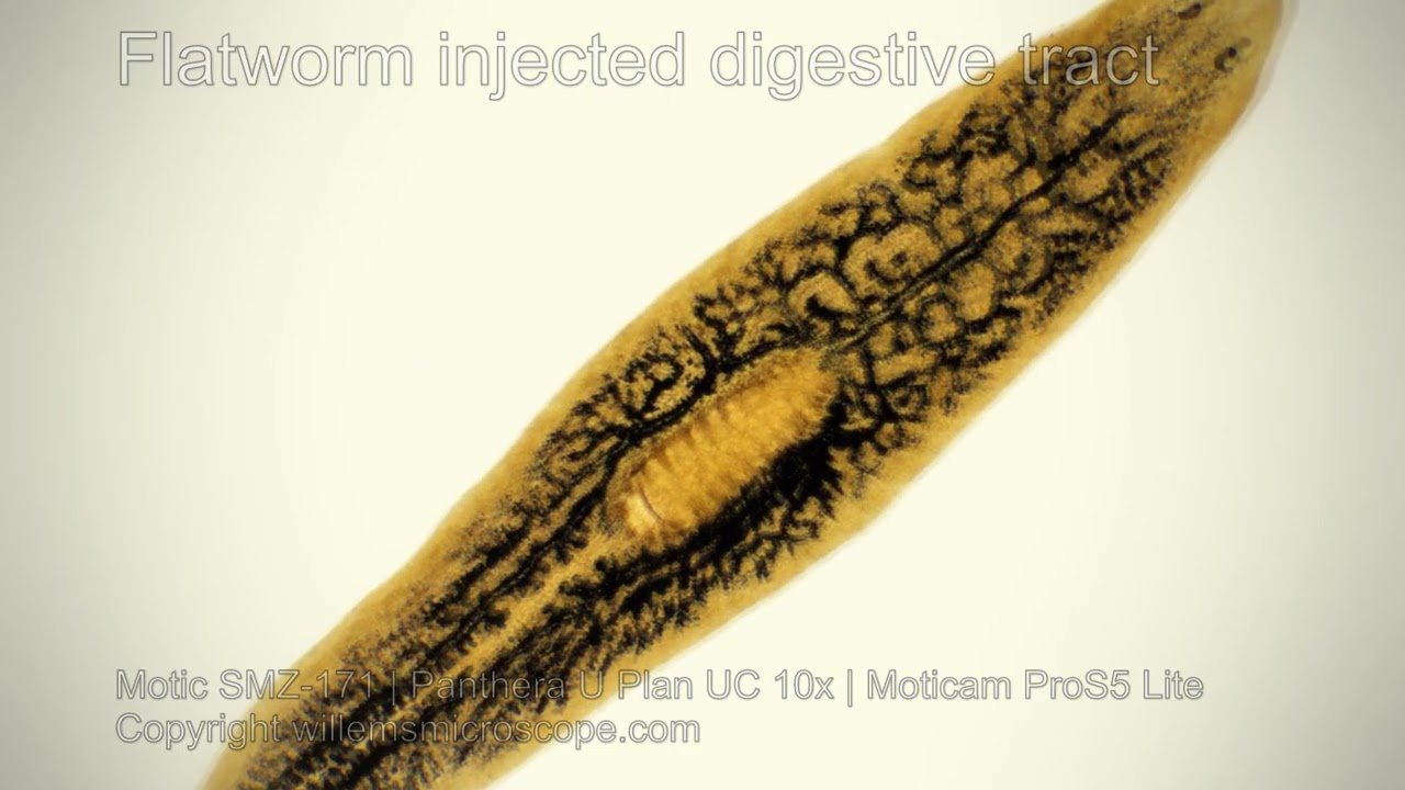Dugesia, freshwater worm digestive tract