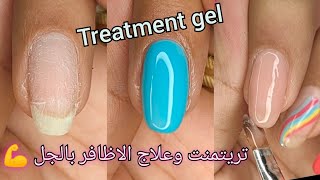 خطوات تريتمنت او علاج الاظافر الضعيفه بالجل 💅❤️ Treatment gel nails 🥰 screenshot 1