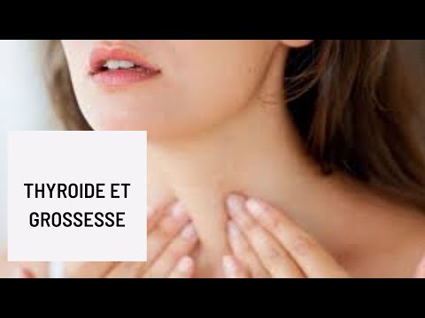 Vidéo: Hypoplasie De La Glande Thyroïde Chez Les Adultes, Les Enfants, Les Adolescents Et Les Femmes