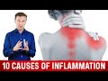 10 Common Causes of Inflammation in the Body | Dr Berg