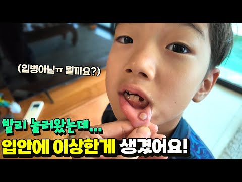 갑자기 입안에 이상하게 생겼어요ㅠㅠ 이게 뭘까요? (입병 아님...) 발리 놀러갔다 무슨일이? 국민이 24시간 가족 일상 | 말이야와친구들
