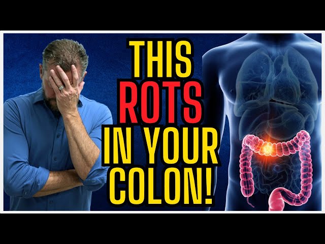 7 Things Rotting in Your Colon Right Now [What Rots in Your Colon?] 2024 class=