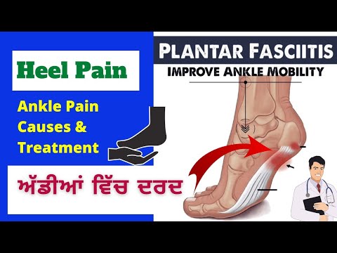 Heel pain(Plantar Fasciitis) ਅੱਡੀਆਂ ਵਿੱਚ ਦਰਦ: ਕਾਰਨ ਅਤੇ ਇਲਾਜ।