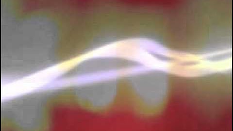 Ex_Tension: What Else