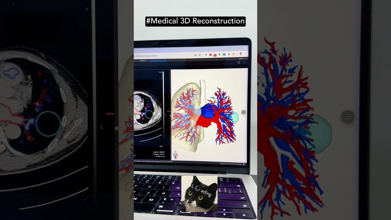 Meet Our Medical 3D Reconstruction AI Platform!
