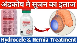 अंडकोष मे सूजन का इलाज|Hydrocele Treatment|Unique Pharmacy