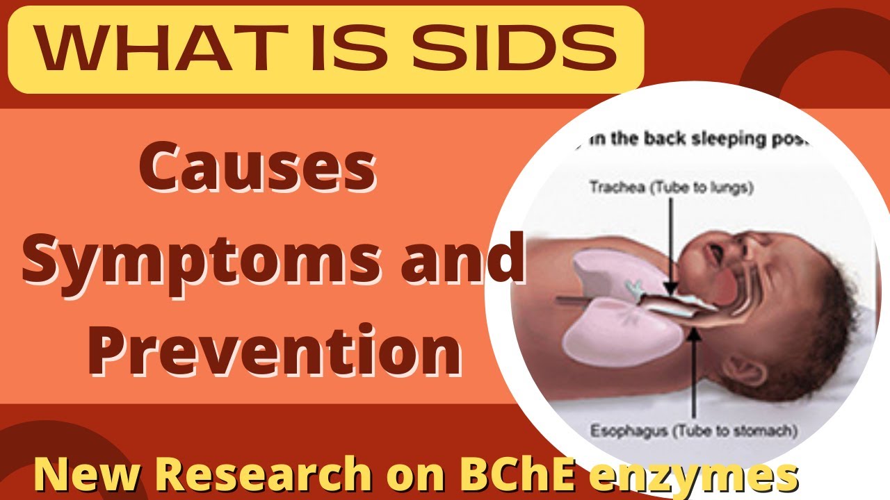 SIDS (Sudden Infant Death Syndrome): Causes & Prevention