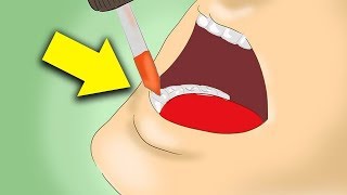 5 Amazing Remedies For Your Toothaches!!! by MadeMyDay 1,808 views 5 years ago 1 minute, 49 seconds