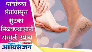 पायांच्या भेगांपासून सुटका मिळवण्यासाठी घरगुती उपाय Remove Cracked Heels Home Remedy | Lokmat Oxygen screenshot 5