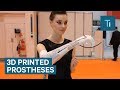 Open Bionics Is Creating Affordable And Stylish 3D Printed Protheses