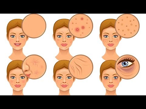 Vídeo: 7 Ingredientes Naturais Para Nunca Usar Em Sua Pele E Por Que