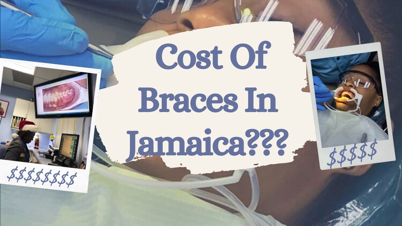 Cost of Braces in Jamaica YouTube