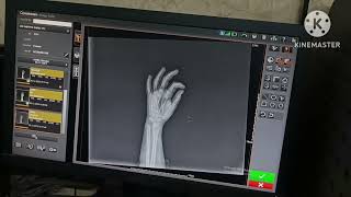 Hand x-ray image processing (how to process hand x-ray image on carestream machine) screenshot 5