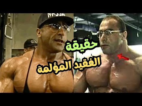 شوف حقيقة البروفيسور ناصر السنباطى ومدى قوى المرحوم