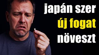 Download Lagu Hamarosan: műfog helyett saját új fog! MP3 Download Lagu Hamarosan: műfog helyett saját új fog! MP3