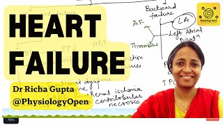 Congestive heart failure pathophysiology , causes, clinical features, treatment