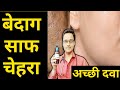 गोरा होने का सबसे आसान तरीका Get fair and clear skin,glowing skin,remove dark spots in one week