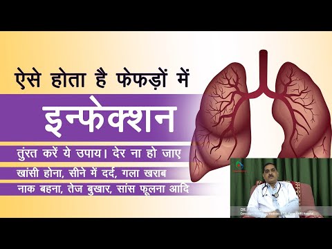 Dr.Prakash Sinha से जानिए फेफड़ों में इन्फेक्शन का ये है उपचार/Covid-19