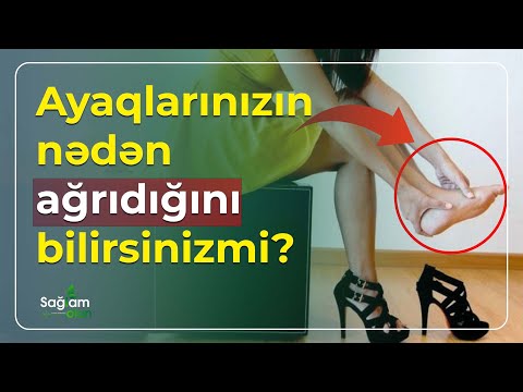 Video: Onurğanın daralması daha da pisləşə bilərmi?