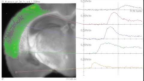 Voltage Sensitive Dye Imaging using New Imaging System, MiCAM05-D225