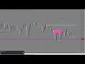 VIX75 Live Trade Mangement