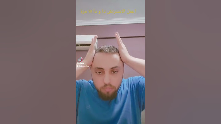 الم الفك من اكل اللبان#الامارات #تعب #طبيعى #الفقرات #التهاب #physiotherapy #الم #تمرين #حجامة #neck