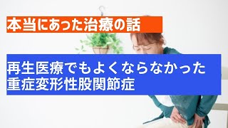 【本当にあった治療の話】再生医療でもよくならなかった重症変形性股関節症の1例