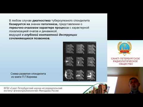 Баулин И.А. Семиотика и дифференциальная диагностика туберкулезного спондилита