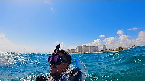 Florida man gets stung by Portuguese Man O’ War