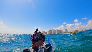 Florida man gets stung by Portuguese Man O’ War