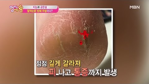 발 혈액순환 방해하는 