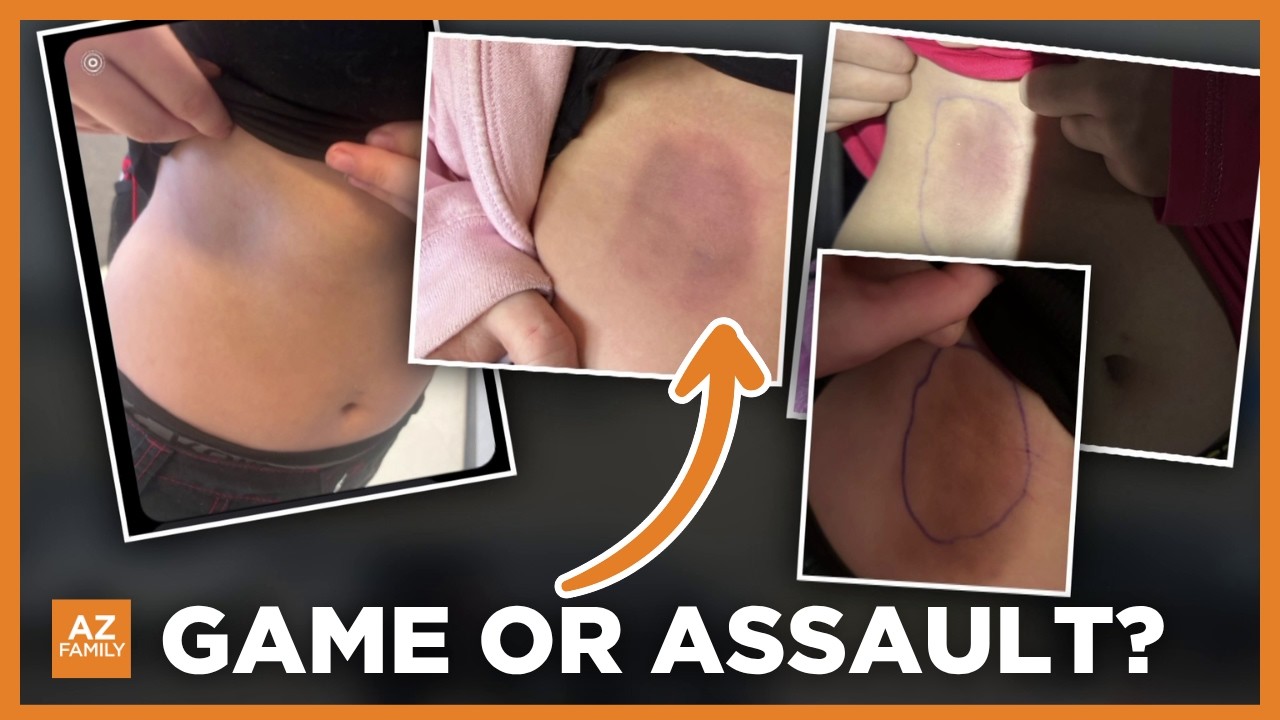 Read "Arizona boy, 13, is charged with assault for ‘relentlessly’ pelting his ex-girlfriend with dodgeballs during gym class warm-up — leaving her hospitalized with softball-sized welts" on SmartNews: https://l.smartnews.com/p-8iCHezyE/rd7gGH