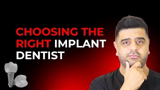 5 Things to Know Before Choosing a Dental Implant Provider 🦷 | Avoid Costly Mistakes