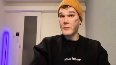 HY USMLE Q #1184 – Hepatobiliary