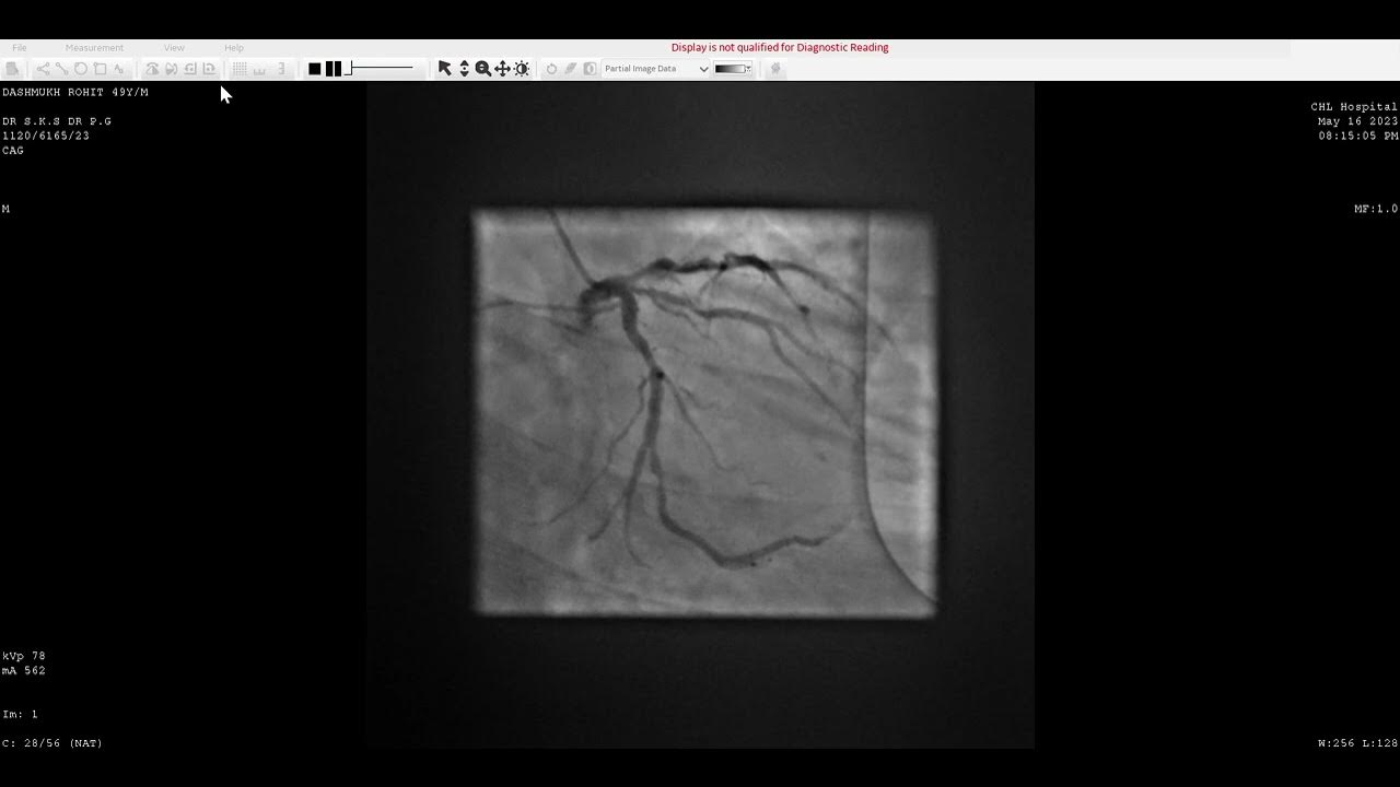 media-viewer-display-is-not-qualified-for-diagnostic-reading-2023-05-17